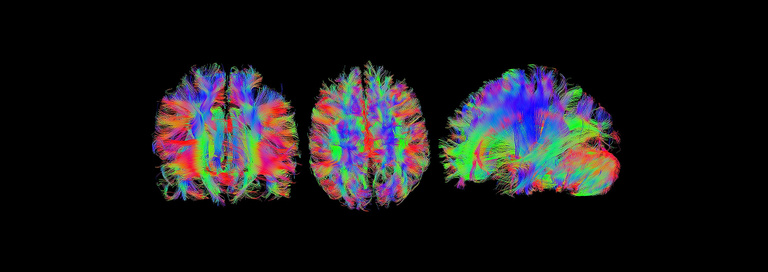 MRI Brain Trio.jpg