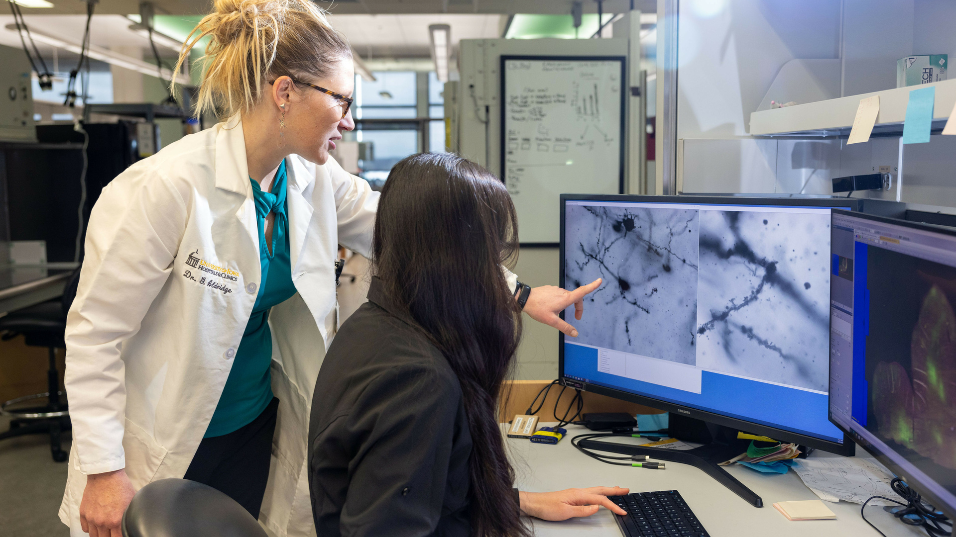 Department of Neurology | Carver College of Medicine | The University ...